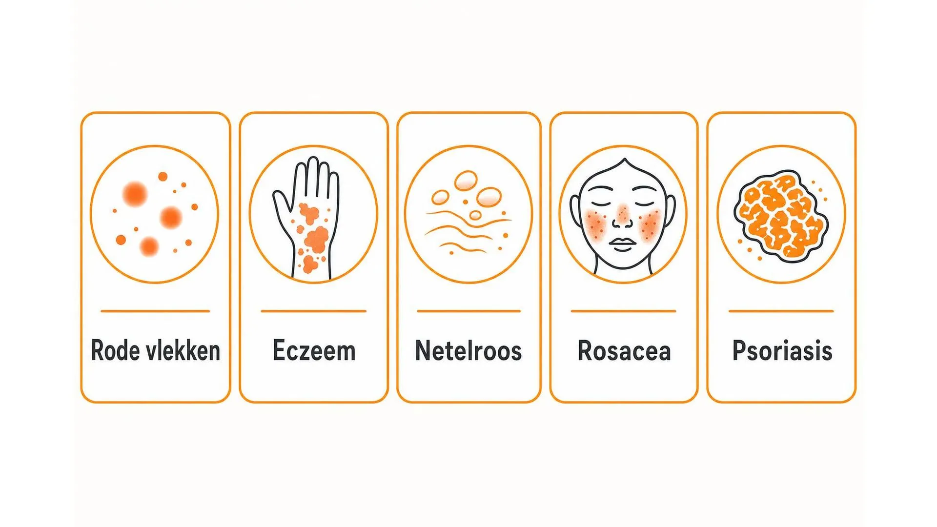 Vijf vormen van huiduitslag die verband houden met stress: rode vlekken, eczeem, netelroos, rosacea en psoriasis
