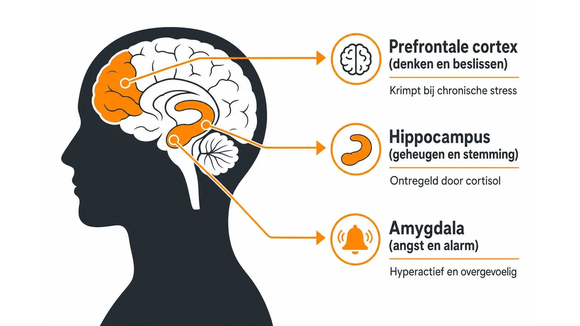 Infographic met drie hersengebieden die worden aangetast door chronische stress: hippocampus, amygdala en prefrontale cortex